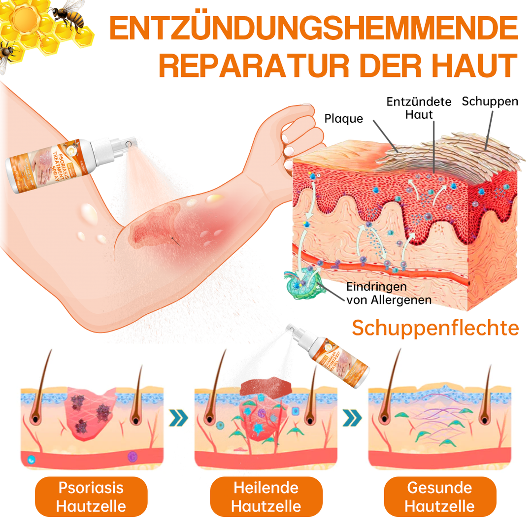 1+1 ZADARMO | Upokojujúci sprej™ zmierňuje suché miesta