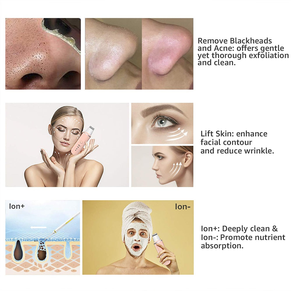 Ultraschall Gesichtsreiniger für Tiefenporenreinigung | 4 Modi: Peeling, Lifting, Ion &amp; Ion+ | Für Mitesser, verstopfte Poren &amp; Glow