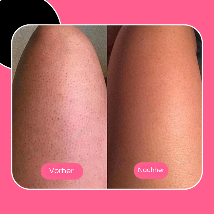 Ultra-Soft Exfoliating Bath Sponge | Usable Without Scrub &amp; Shower Gel | For Smoother, Fresher Skin | Ideal for Sensitive Skin