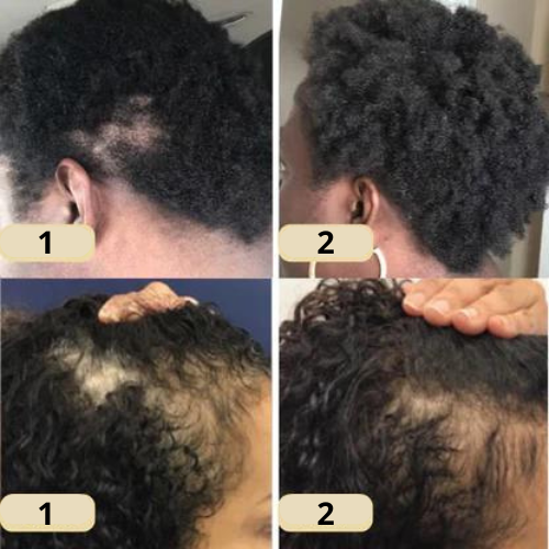 Arvilaro: Your natural hair growth oil