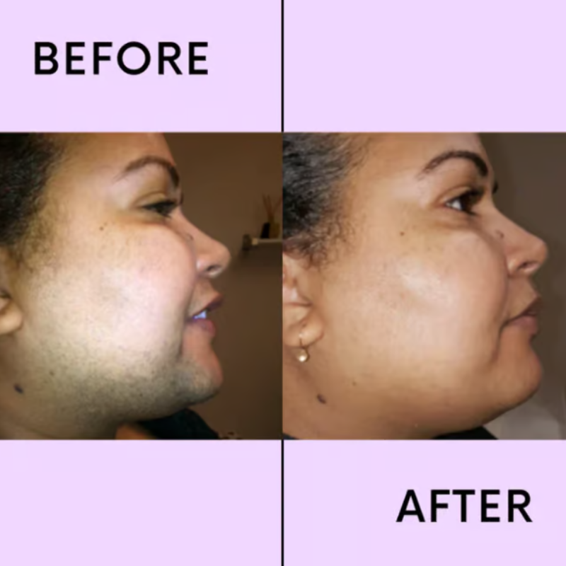 SmoothEase – Crema depilatoria senza sforzo