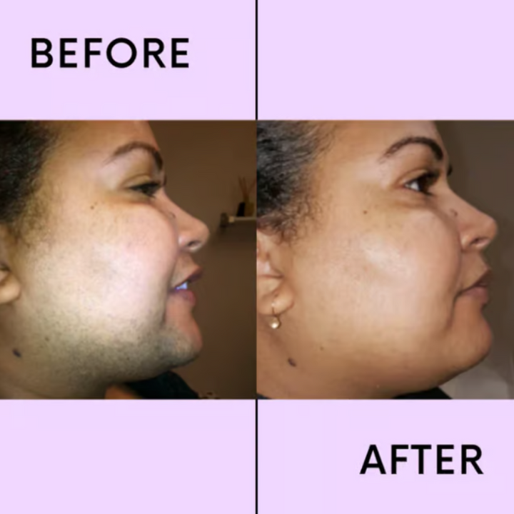 SmoothEase – Crema depilatoria senza sforzo