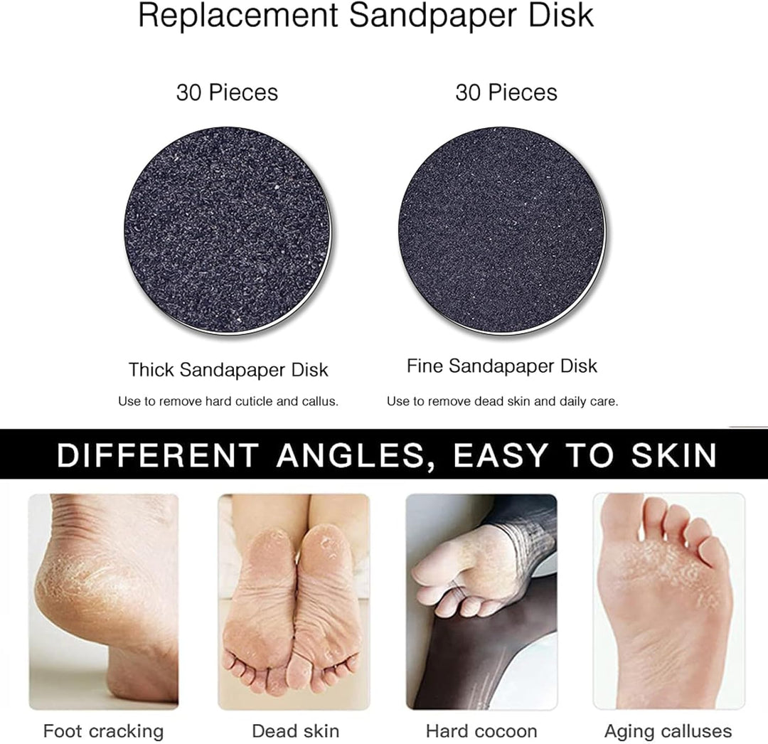 Electric foot callus remover | Pedicure tool with rotating discs + extra pads | USB connection | Smooth heels at home