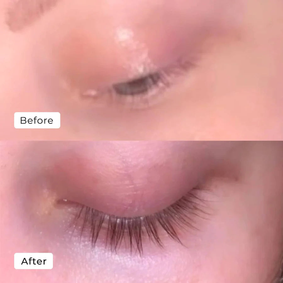 LumaLash™ — Erwachen Sie zu natürlich dichteren, volleren Wimpern in nur 7 Tagen.