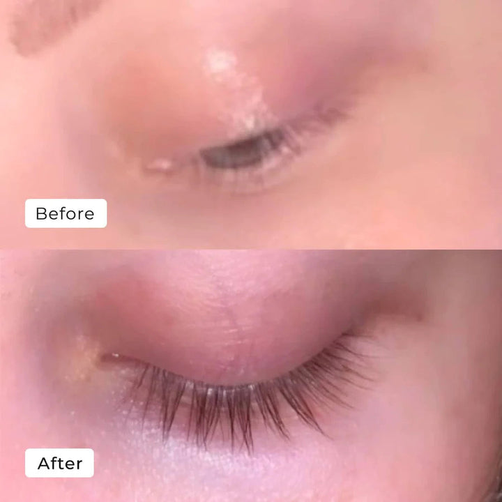LumaLash™ — Erwachen Sie zu natürlich dichteren, volleren Wimpern in nur 7 Tagen.