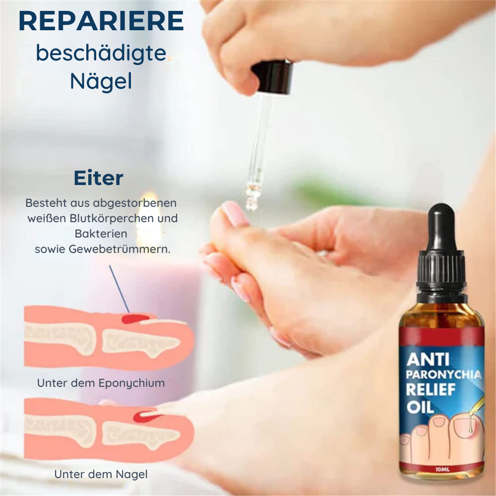 Nail &amp; cuticle oil 10 ml | Absorbs quickly in 30 sec. | Cares for irritated nail edges &amp; discolored nails | Natural