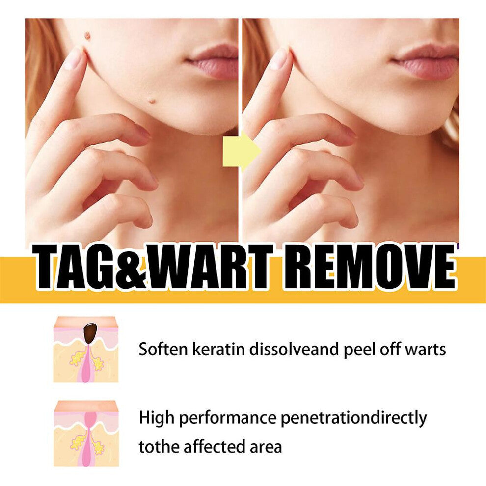Skin tag care pen 3 ml | Precision applicator for skin spots | Fast-drying serum for targeted care