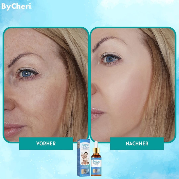 GlowTight™ Lifting-Serum | Straffendes &amp; Feuchtigkeitsspendendes Anti-Aging-Serum | Für Glattere &amp; Elastischere Haut