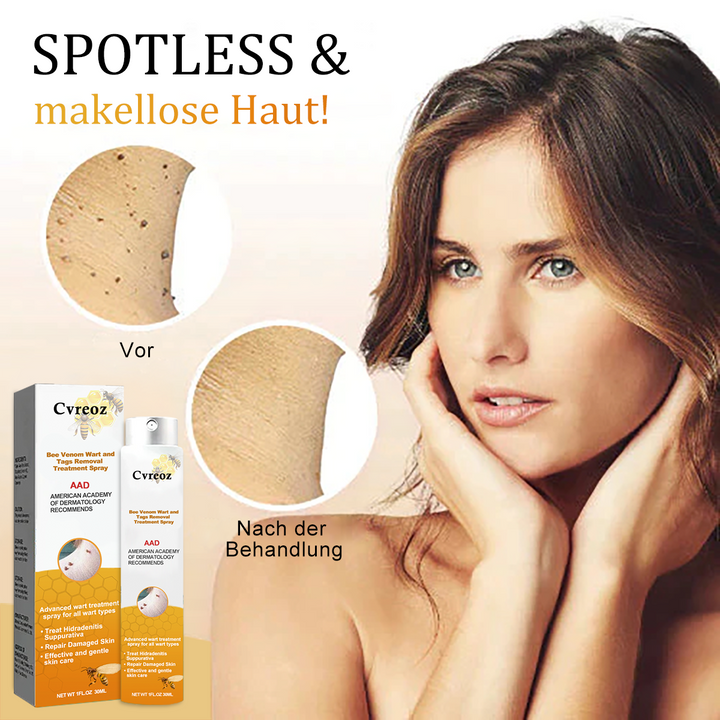 1+1 gratis | Skin Free™ l Tutte le macchie, nei e verruche vengono eliminate al 90% entro 3 giorni!