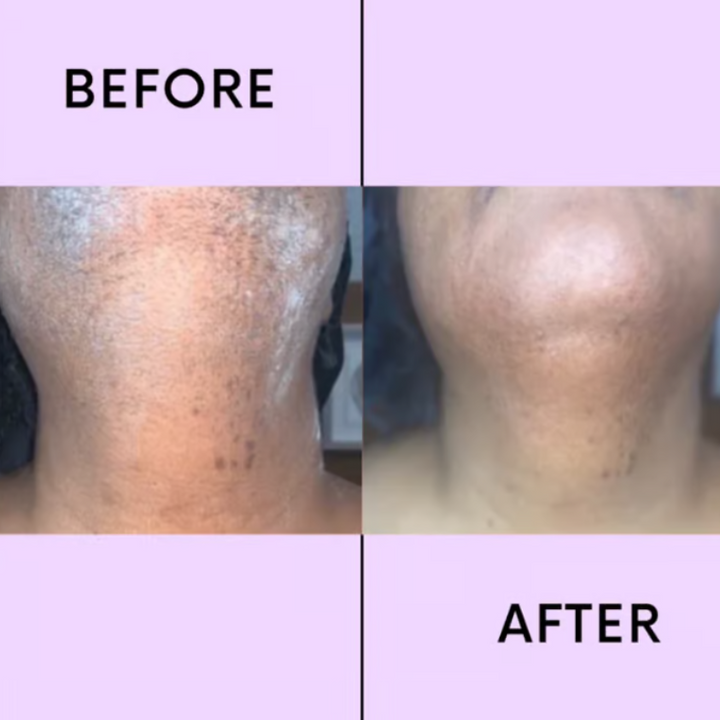 SmoothEase – Crema depilatoria senza sforzo
