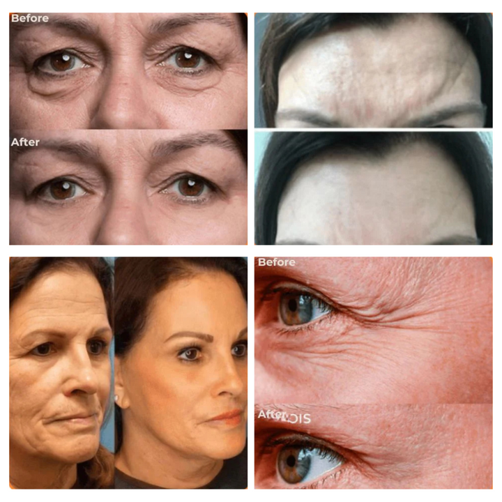 PerfectSync™ — feine Linien entfernen &amp; natürlich strahlen | 1+1 GRATIS heute