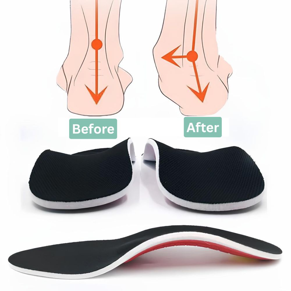 ArchEase™ - orthopädische Einlegesohle zur Unterstützung des Fußgewölbes (1+1 GRATIS – 2 Paare)