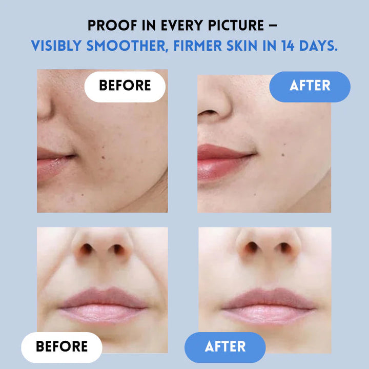 Gesicht-Lifting-Strips für sofort straffere Haut | Ultradünn &amp; atmungsaktiv | Unsichtbar unter Make-up | Für Gesicht, Augen &amp; Stirn