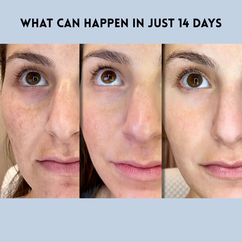 Gesicht-Lifting-Strips für sofort straffere Haut | Ultradünn &amp; atmungsaktiv | Unsichtbar unter Make-up | Für Gesicht, Augen &amp; Stirn