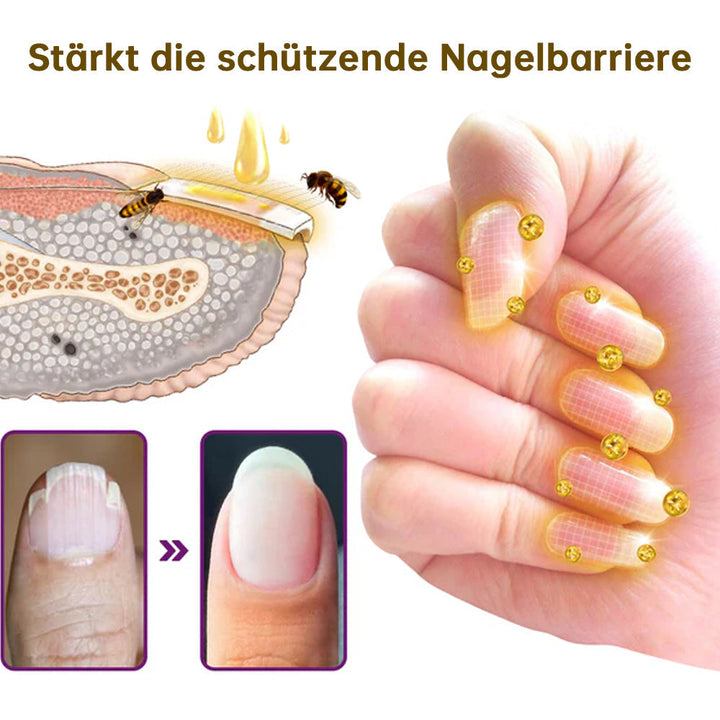 1+1 FREE | MushroomShield™ Eliminates nail fungus