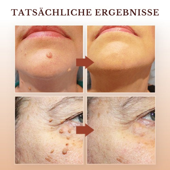 Sérum soin localisé 3 ml | Applicateur de précision pour une application ciblée | Séchage rapide et hygiénique | Pour usage domestique