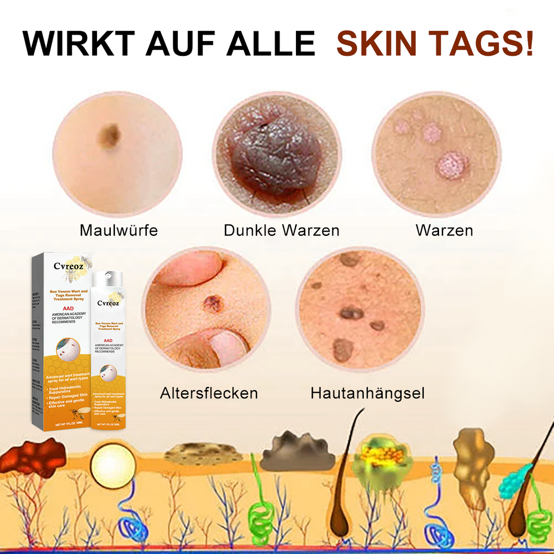 1+1 gratis | Skin Free™ l Tutte le macchie, nei e verruche vengono eliminate al 90% entro 3 giorni!