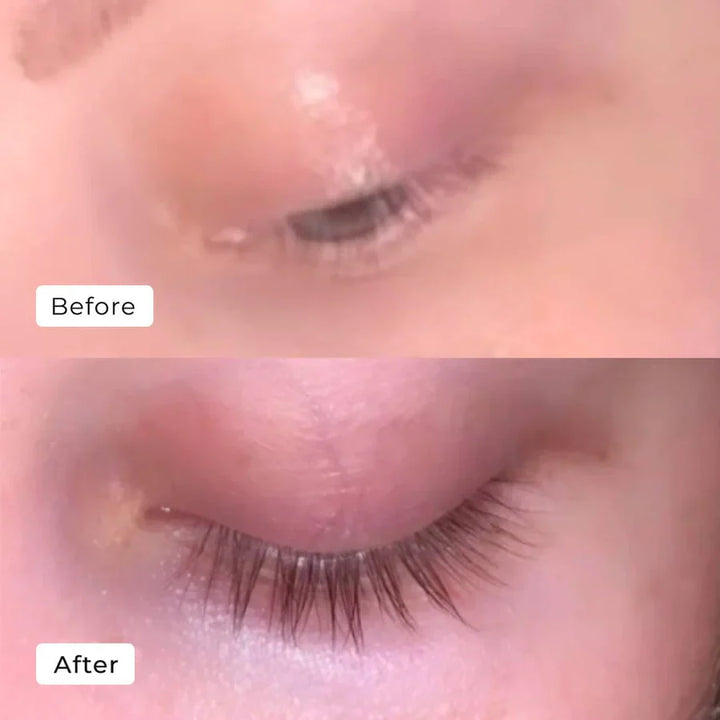 2+1 Gratis | WimpernWuchs™ Natürlicher Wimpernschub