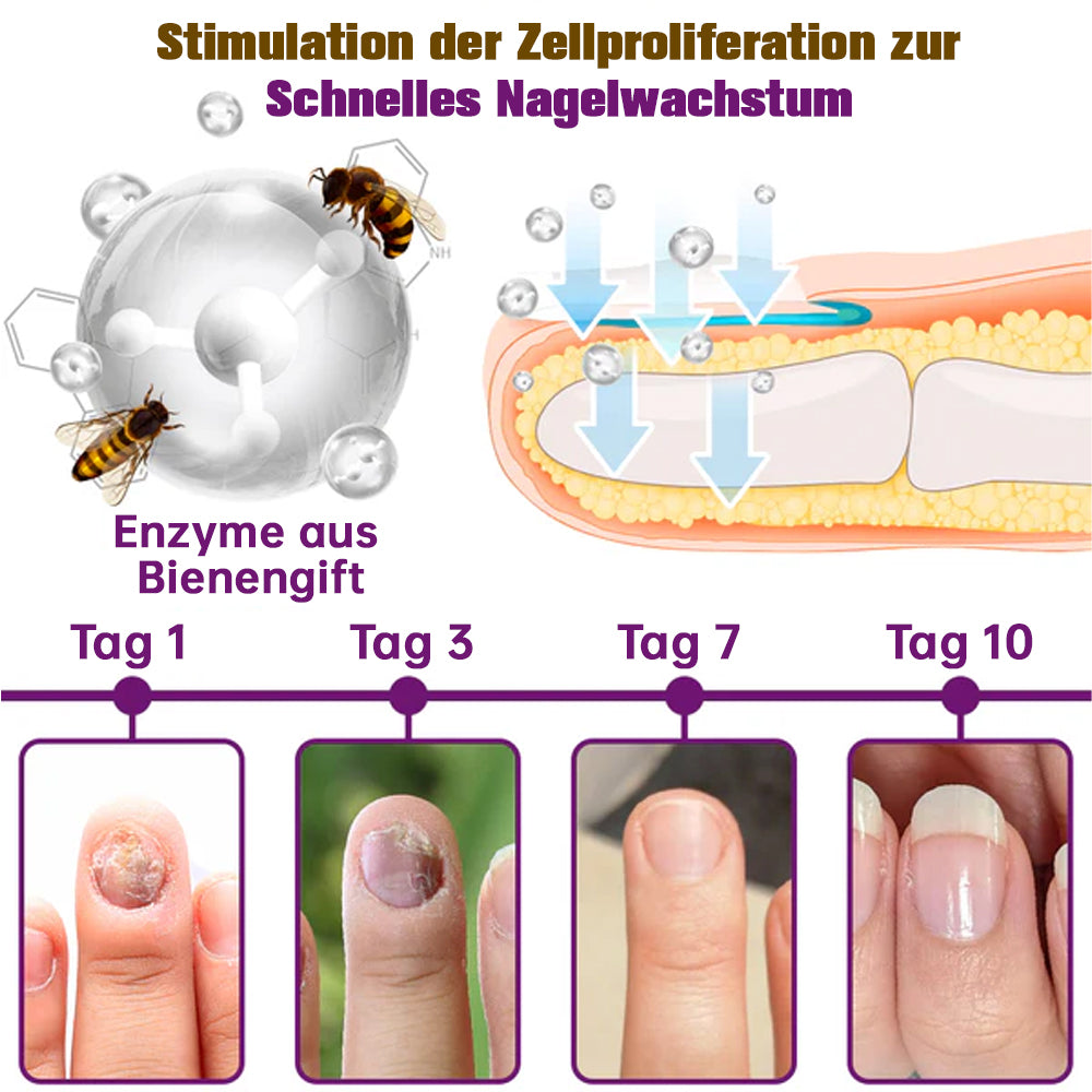 1+1 FREE | MushroomShield™ Eliminates nail fungus