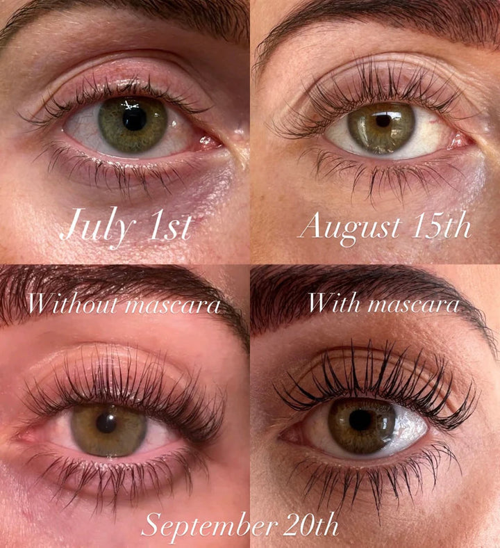LumaLash™ — Erwachen Sie zu natürlich dichteren, volleren Wimpern in nur 7 Tagen.