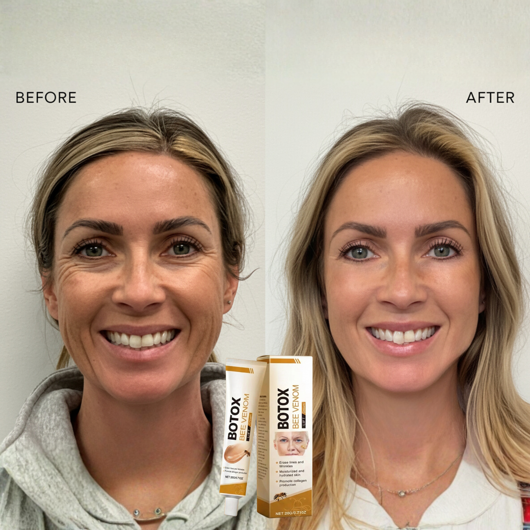 Augencreme mit Bienengift 20 g | Straffende Augenpflege für feine Linien &amp; müde Augen | Feuchtigkeitsspendende Lift-Creme