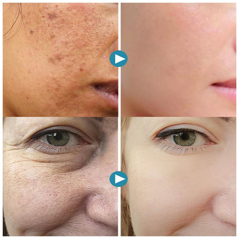 Porenverfeinernde Make-up-Grundierung | Sofort glatter Look, kaschiert Poren &amp; feine Linien | Wasserfest &amp; langanhaltend | Leicht, atmungsaktiv