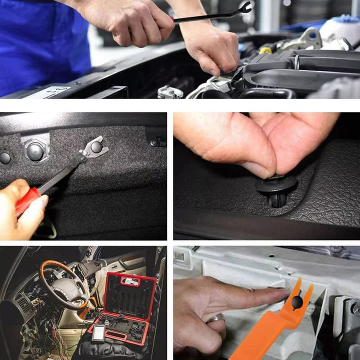 SnapGuard – 725 clips de fixation auto – kit de base