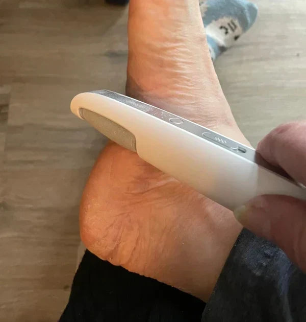 Sähköinen kovettumien poistaja jaloille | 360° kierto, 3 nopeusasetusta | ladattava ja ergonominen