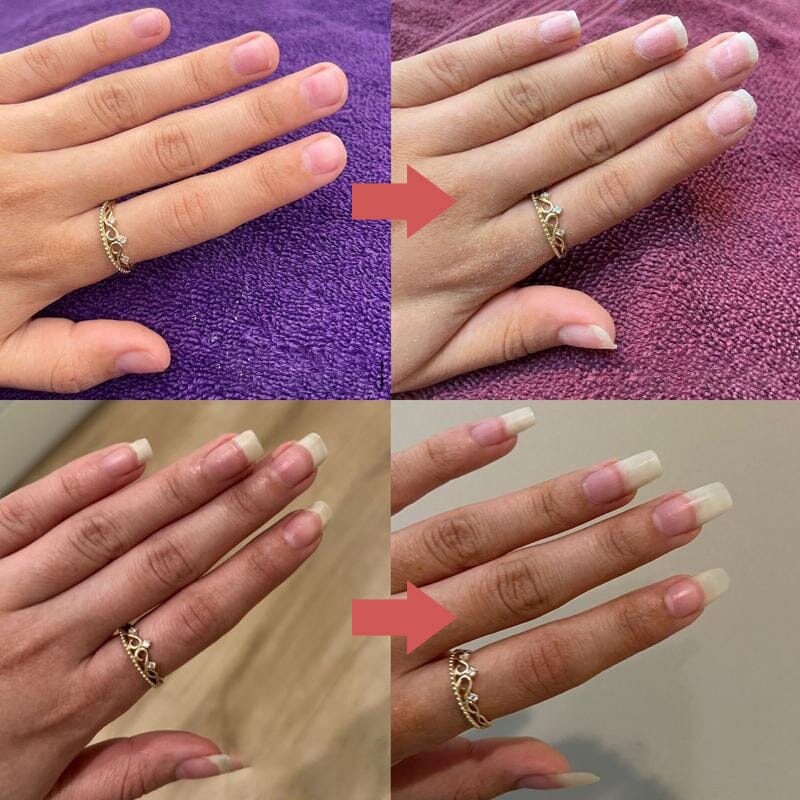 Seranail | nährstoffreiches Nagelwachstumsöl