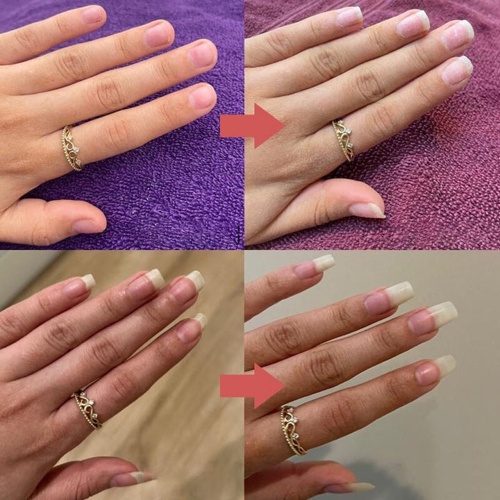 Seranail | nährstoffreiches Nagelwachstumsöl