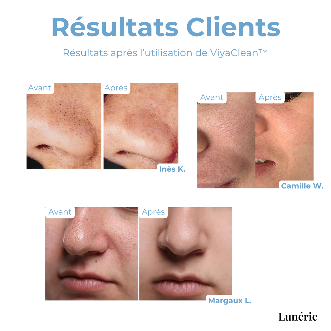 FrischPoren™ Skin Renewal Therapy