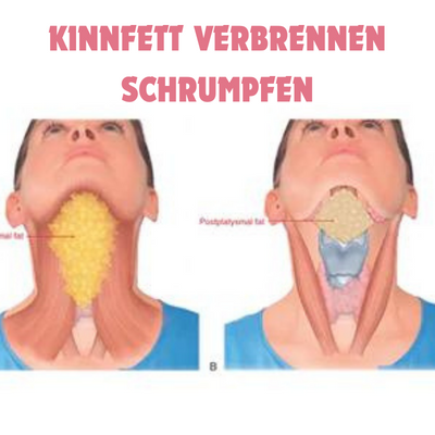 GesichtForm™ Defining Jawline Optimization