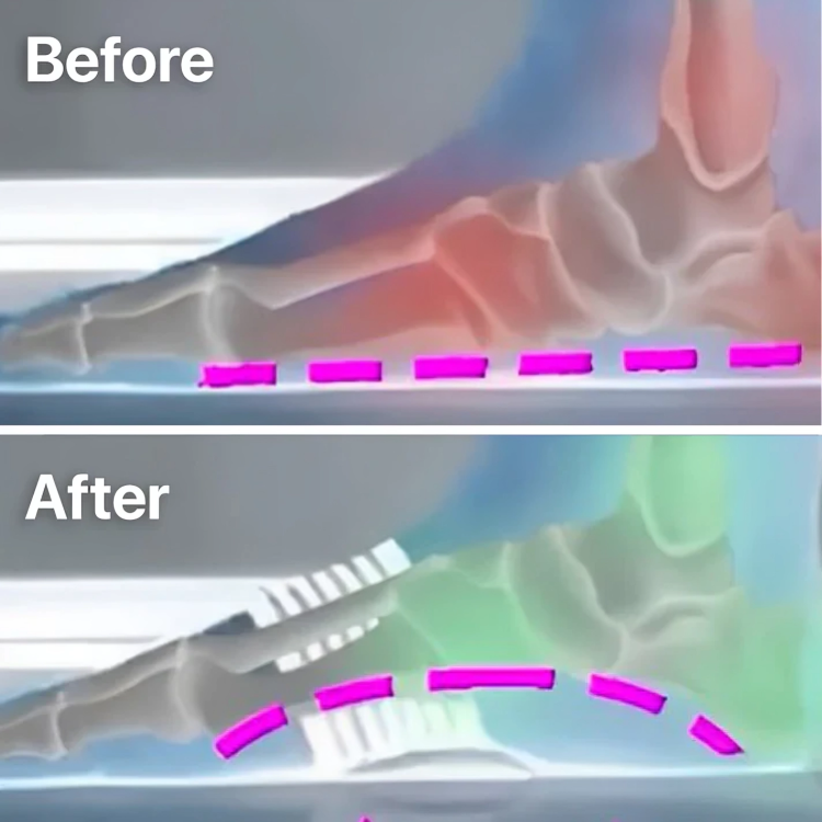 1+1 GRATUIT| Patchs anti-douleur™ soulagement immédiat des pieds