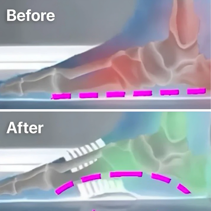 1+1 GRATUIT| Patchs anti-douleur™ soulagement immédiat des pieds