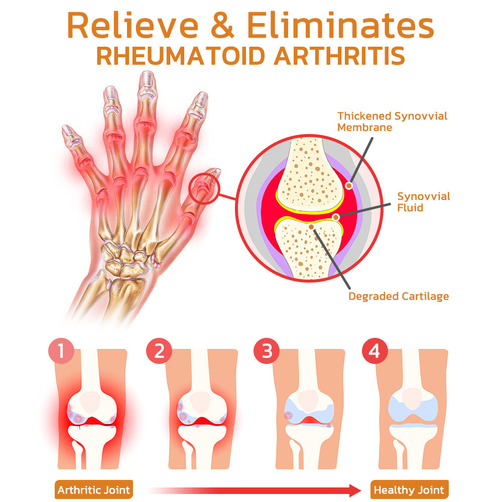 BeehiveMagic™ Bee venom joint and bone therapy spray