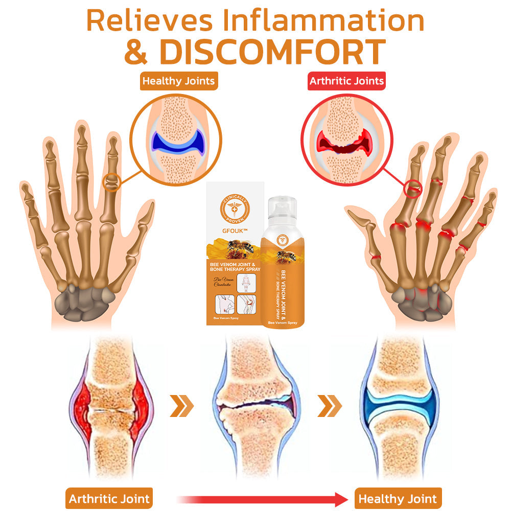 BeehiveMagic™ Bee venom joint and bone therapy spray
