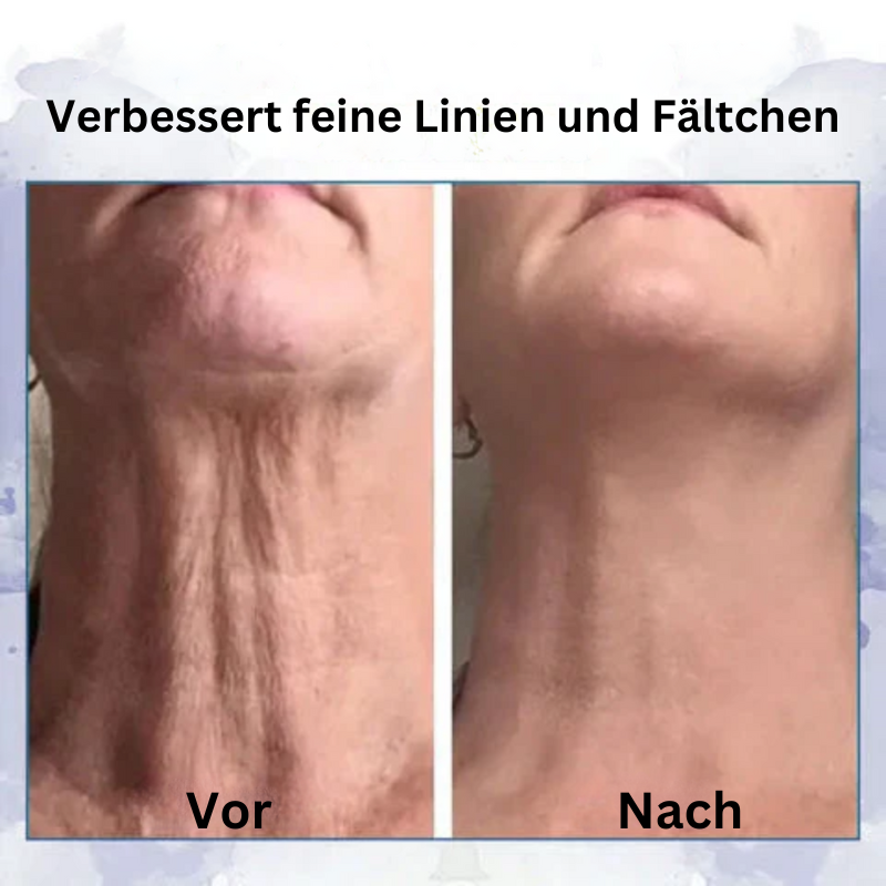 HebeCreme™ ránctalanító, feszesítő többfunkciós krém