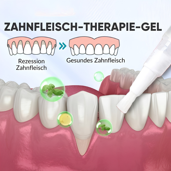 Gel soin des gencives à l&