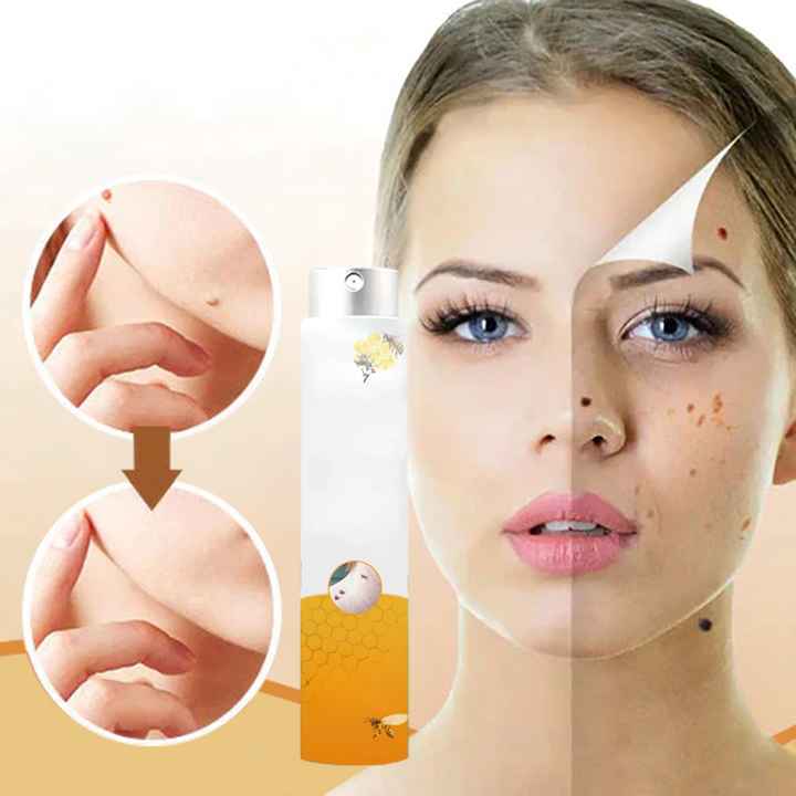 1+1 gratis | Skin Free™ l Tutte le macchie, nei e verruche vengono eliminate al 90% entro 3 giorni!