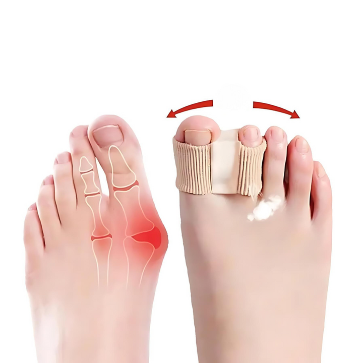 Premium Zehentrenner | Elastische Separatoren für Ballenzehen &amp; Fehlstellungen | Nylon &amp; SEBS