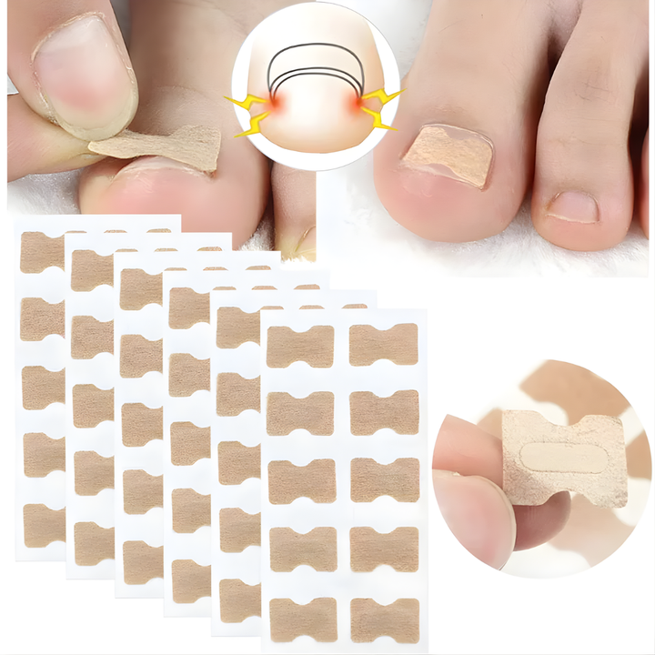 NägelNachbessern™ Pflegeaufkleber | Sanfte Nagelkorrektur &amp; Glättung | Für Gesundes, Natürliches Nagelwachstum