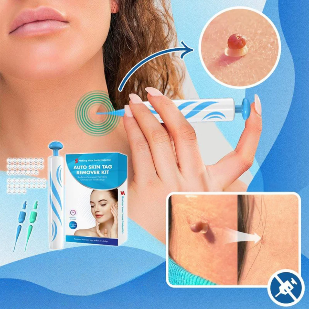 WarzenReinigen™ | Hautpflege-Set zur Entfernung von Hautunreinheiten &amp; Warzen | Schonend &amp; Einfach