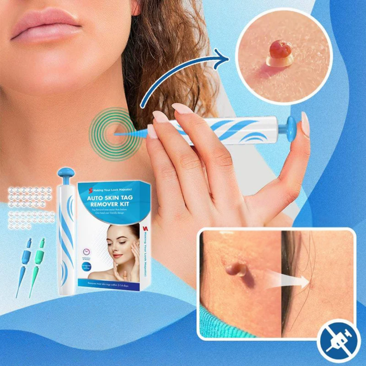 WarzenReinigen™ | Hautpflege-Set zur Entfernung von Hautunreinheiten &amp; Warzen | Schonend &amp; Einfach