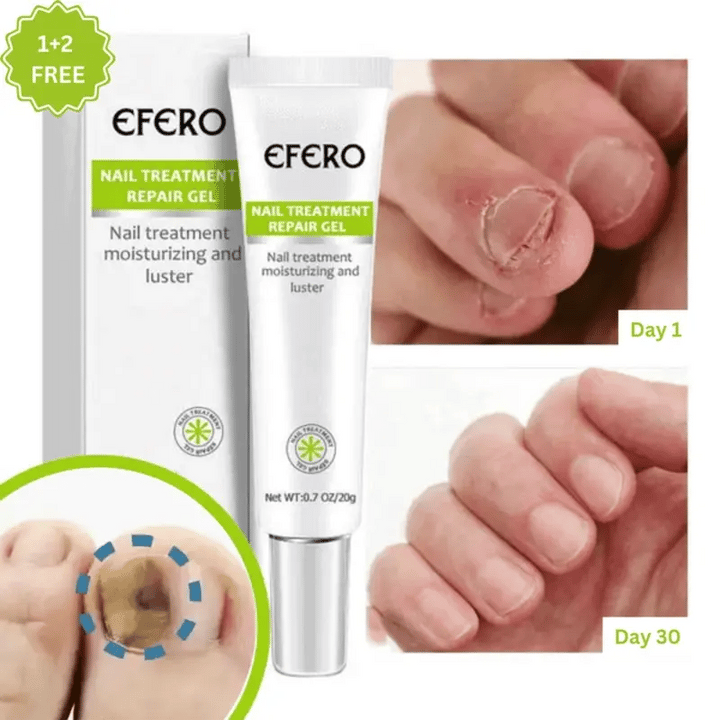 Efero® nail repair gel: 1 + 2 FREE – limited time offer