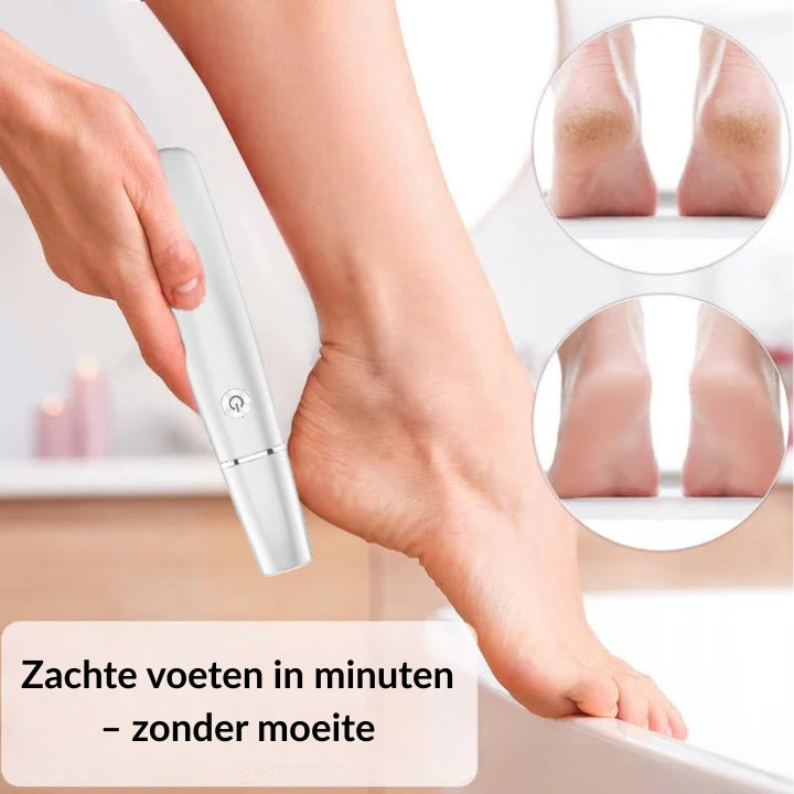 SilkySole™ – Okamžite hodvábne hladké nohy