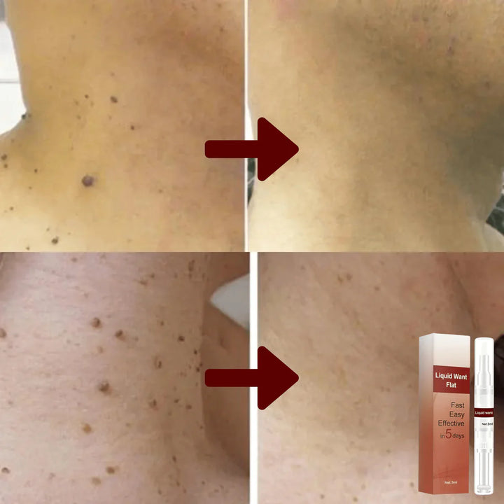Ápoló bőrszérum 3 ml teafaolajjal és gyógynövény-kivonatokkal | Arcra és testre | Gyorsan beszívódik | Minden bőrtípusra
