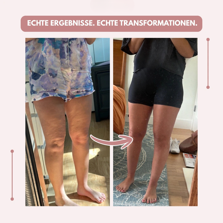 Kompressionsleggings Damen | Hoch geschnittene 3D-Leggings mit formendem Sitz