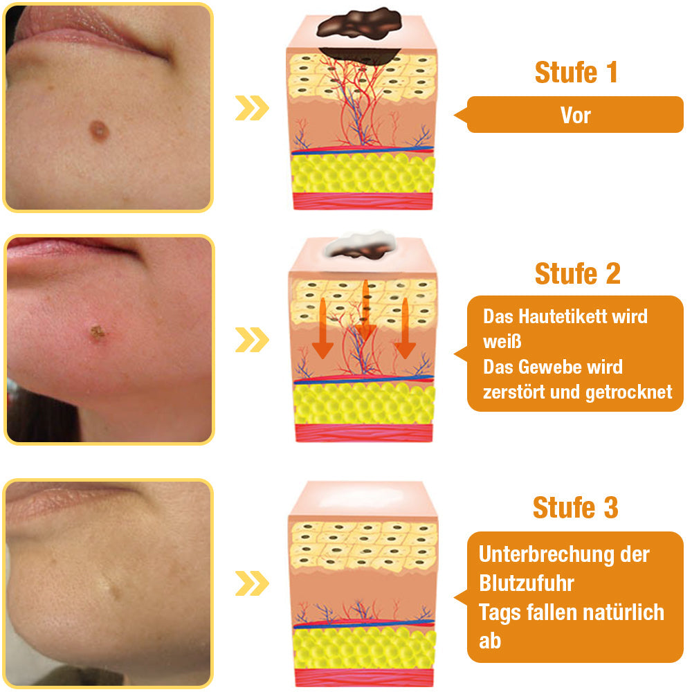 Care spray with bee venom extract | Soothes &amp; moisturizes | For smoother-looking skin, 30 ml, quick application