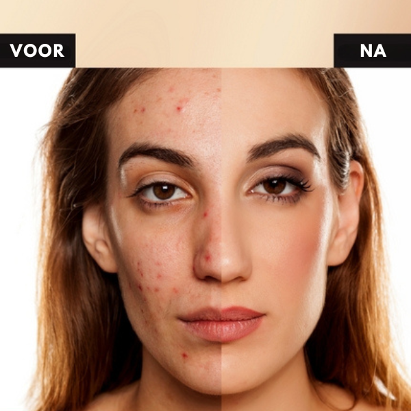 Mila - Dreifarbiges Concealer-Palette