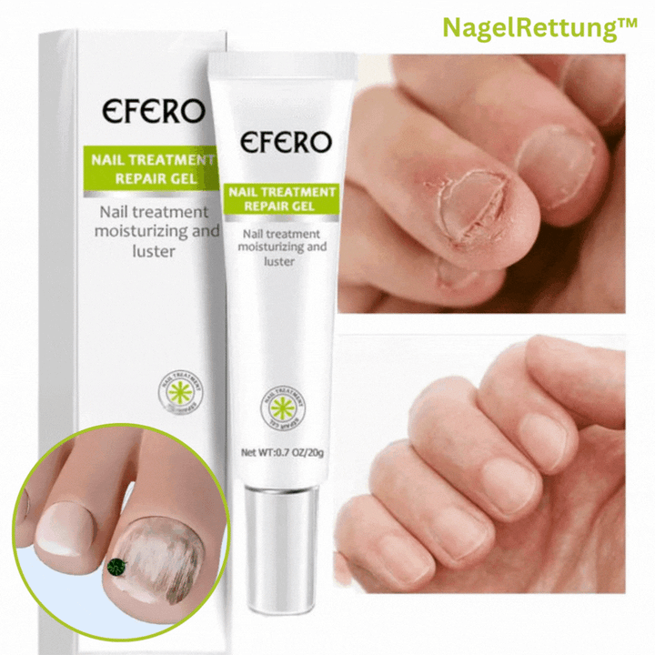 Gel per la cura delle unghie per unghie scolorite e fragili | Supporta un aspetto curato | Facile da applicare, asciugatura rapida | Set da 3